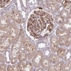 TNS3 Antibody, Novus Biologicals 25 &mu;L, Unlabeled:Antibodies, Polyclonal