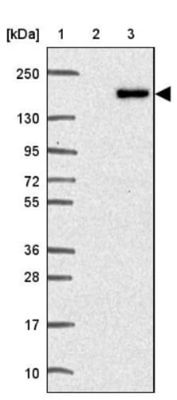 TNS3 Antibody, Novus Biologicals 25 &mu;L, Unlabeled:Antibodies, Polyclonal