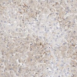 TOM1L2 Antibody, Novus Biologicals 25 &mu;L; Unlabeled:Antibodies, Polyclonal