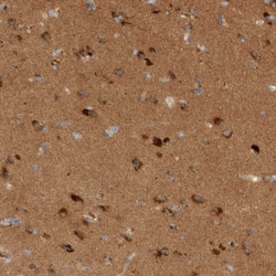 DPS Antibody, Novus Biologicals:Antibodies:Primary Antibodies