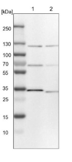 TOM1L2 Antibody, Novus Biologicals 25 &mu;L; Unlabeled:Antibodies, Polyclonal