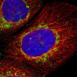 TOM70 Antibody, Novus Biologicals 0.1mL; Unlabeled:Antibodies, Polyclonal