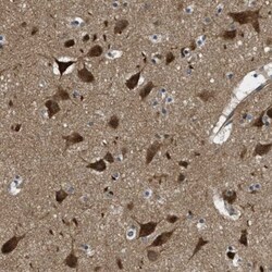 TOM70 Antibody, Novus Biologicals 0.1mL; Unlabeled:Antibodies, Polyclonal