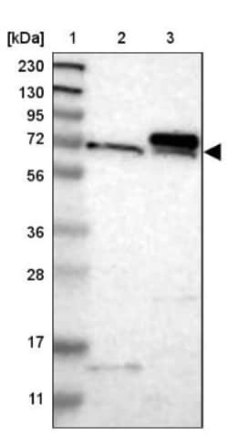 TOM70 Antibody, Novus Biologicals 0.1mL; Unlabeled:Antibodies, Polyclonal