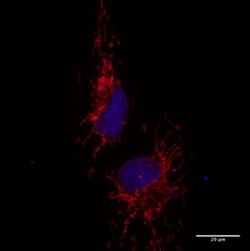 TOMM20 Antibody, Novus Biologicals 0.1mL; Unlabeled:Anticorps, Polyclonal