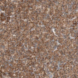 TOMM20 Antibody, Novus Biologicals 0.1mL; Unlabeled:Anticorps, Polyclonal