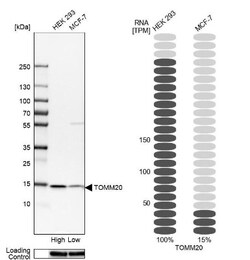 TOMM20 Antibody, Novus Biologicals 0.1mL; Unlabeled:Anticorps, Polyclonal