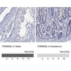 TOMM20L Rabbit anti-Human, Polyclonal, Novus Biologicals 25 &mu;g; Unconjugated:Antibodies,