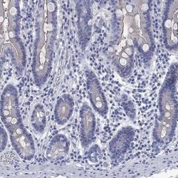TOMM20L Rabbit anti-Human, Polyclonal, Novus Biologicals 25 &mu;g; Unconjugated:Antibodies,
