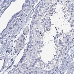 TOMM20L Rabbit anti-Human, Polyclonal, Novus Biologicals 25 &mu;g; Unconjugated:Antibodies,