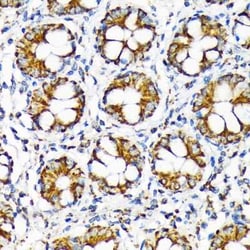TOMM22 Rabbit anti-Human, Mouse, Rat, Clone: 6R1L7, Novus Biologicals 20
