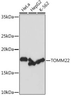 TOMM22 Rabbit anti-Human, Mouse, Rat, Clone: 6R1L7, Novus Biologicals 20