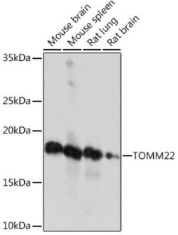 TOMM22 Rabbit anti-Human, Mouse, Rat, Clone: 6R1L7, Novus Biologicals 20