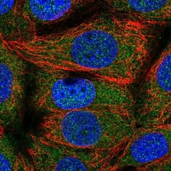 TOMM34 Antibody, Novus Biologicals 0.1mL; Unlabeled:Antibodies, Polyclonal