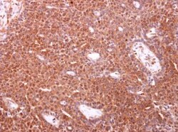 TOMM34 Antibody, Novus Biologicals 0.1mL; Unlabeled:Antibodies, Polyclonal