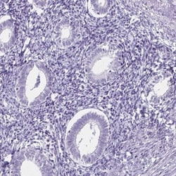 TOMM34 Antibody, Novus Biologicals 0.1mL; Unlabeled:Antibodies, Polyclonal