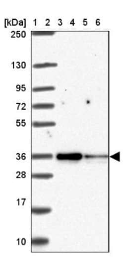 TOMM34 Antibody, Novus Biologicals 0.1mL; Unlabeled:Antibodies, Polyclonal