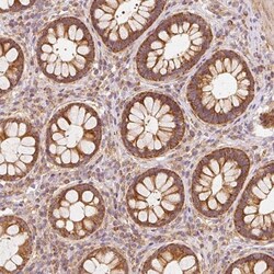 TOMM40 Antibody, Novus Biologicals 0.1mL; Unlabeled:Antibodies, Polyclonal