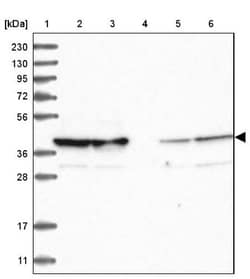 TOMM40 Antibody, Novus Biologicals:Antibodies:Primary Antibodies