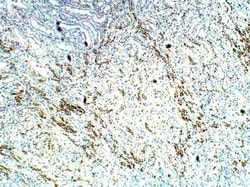 TOMM5 Antibody, Novus Biologicals:Antibodies:Primary Antibodies