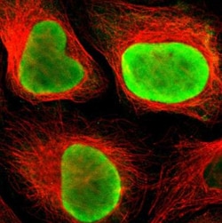 TOP2A Antibody, Novus Biologicals 25 &mu;L; Unlabeled:Antibodies, Polyclonal