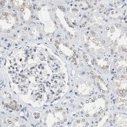 TOP2A Antibody, Novus Biologicals 25 &mu;L; Unlabeled:Antibodies, Polyclonal
