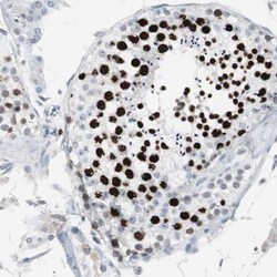 TOP2A Antibody, Novus Biologicals 25 &mu;L; Unlabeled:Antibodies, Polyclonal