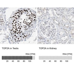 TOP2A Antibody, Novus Biologicals 25 &mu;L; Unlabeled:Antibodies, Polyclonal