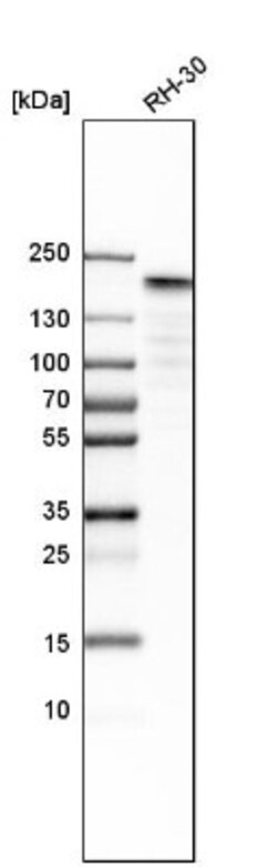TOP2A Antibody, Novus Biologicals 25 &mu;L; Unlabeled:Antibodies, Polyclonal