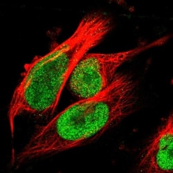 TOP2B Antibody, Novus Biologicals 0.1mL; Unlabeled:Antibodies, Polyclonal