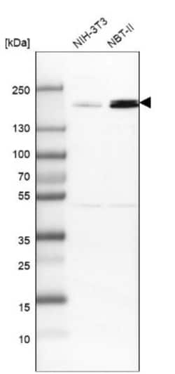 TOP2B Antibody, Novus Biologicals 0.1mL; Unlabeled:Antibodies, Polyclonal