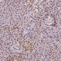 TOPORS Antibody, Novus Biologicals:Antibodies:Primary Antibodies