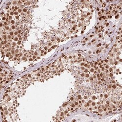 TOPORS Antibody, Novus Biologicals:Antibodies:Primary Antibodies