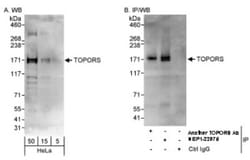 TOPORS Antibody, Novus Biologicals 0.1mL; Unlabeled:Antibodies, Polyclonal