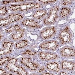 TOR1AIP2 Antibody, Novus Biologicals 0.1mL; Unlabeled:Antibodies, Polyclonal