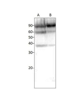 TORC2 Antibody, Novus Biologicals 100 &mu;g | Buy Online | Novus Biologicals | Fisher Scientific