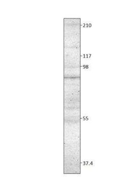 TORC2 Antibody, Novus Biologicals 100 &mu;g | Buy Online | Novus Biologicals | Fisher Scientific