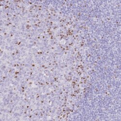 TOX2 Antibody, Novus Biologicals 25 &mu;L, Unlabeled:Antibodies, Polyclonal