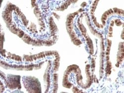 TOX3 Antibody (TOX3/1123), Novus Biologicals 0.2mg; Unlabeled:Antibodies,