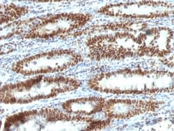 TOX3 Antibody (TOX3/1123), Novus Biologicals 0.2mg; Unlabeled:Antibodies,