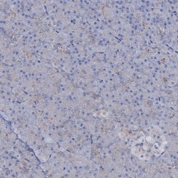 TOX3 Antibody, Novus Biologicals 25 &mu;L; Unlabeled:Antibodies, Polyclonal