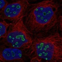 TP53TG5 Rabbit anti-Human, Polyclonal, Novus Biologicals 100 &mu;g | Buy Online | Novus Biologicals | Fisher Scientific