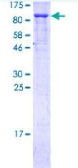 Novus Biologicals Recombinant Human p73 GST (N-Term) Protein 10 &mu;g | Buy Online | Novus Biologicals&trade; | Fisher Scientific
