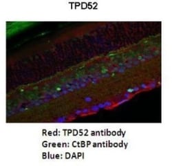 TPD52 Antibody, Novus Biologicals:Antibodies:Primary Antibodies
