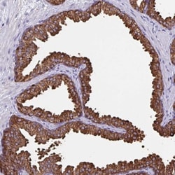 TPD52 Antibody, Novus Biologicals 0.1mL; Unlabeled:Antibodies, Polyclonal