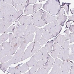 TPD52 Antibody, Novus Biologicals 0.1mL; Unlabeled:Antibodies, Polyclonal