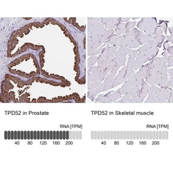 TPD52 Antibody, Novus Biologicals 0.1mL; Unlabeled:Antibodies, Polyclonal