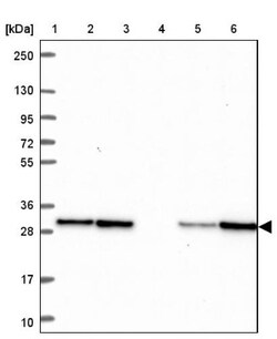TPD52 Antibody, Novus Biologicals 0.1mL; Unlabeled:Antibodies, Polyclonal