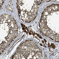 TPGS2 Antibody, Novus Biologicals:Antibodies:Primary Antibodies