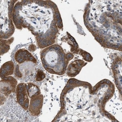TPK1 Antibody, Novus Biologicals 0.1mL; Unlabeled:Antibodies, Polyclonal